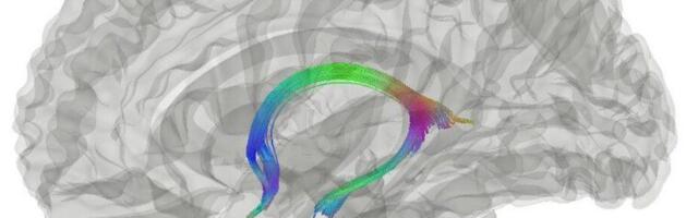 Doktoritöö: koorilaul võib suurendada aju heaolu