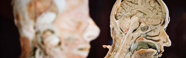 Supervanurite aju kaitseb mälukaotuse eest eriline epigeneetiline kilp