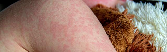 “Lapsevanemad lihtsalt ei vasta vaktsineerimiskutsetele”. Kooliõed hoiatavad vaktsineerimata laste arvu järsu kasvu eest