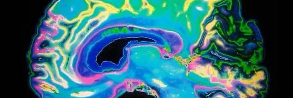 Uus avastus: aju vajab rasva