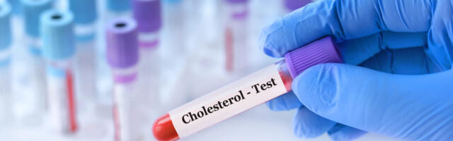 Üllatav statistika: isegi noortel naistel on kolesterool liiga kõrge – arst selgitab, miks risk menopausiga hüppeliselt kasvab