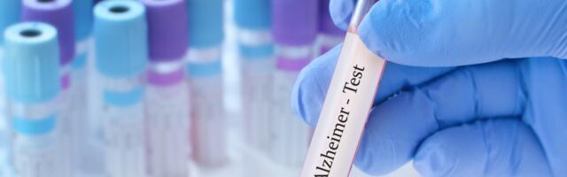 Uuring: uus vereproov näitab Alzheimeri staadiumit enne sümptomite süvenemist