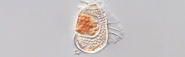 Ei viirus ega bakter_ Jaapani teadlased avastasid eluvormi, mis ei sobi ühegi senise kategooria alla