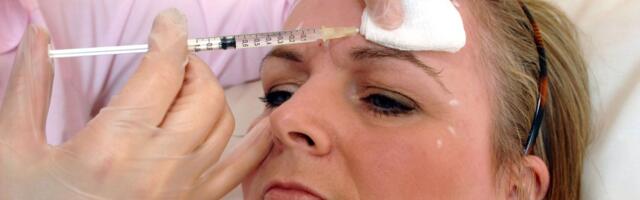 "ВИГЛЯД НЕ ДУЖЕ ЕСТЕТИЧНИЙ!“ Дедалі більше жінок вирішує розчинити наповнювачіру щоки ще більше"